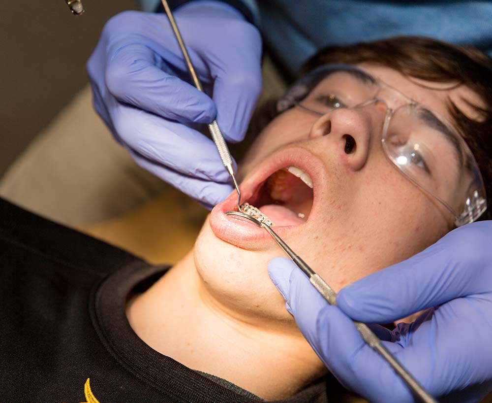 young man getting braces checked